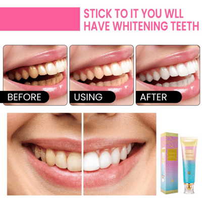 Pâte dentifrice blanchissante
