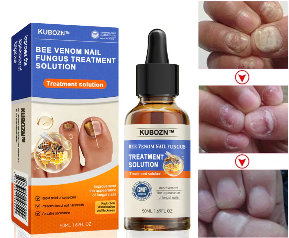 Traitement Naturel Anti-Mycose au Venin d’Abeille