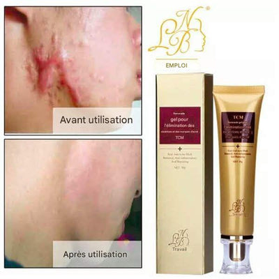 🌿Gel Anti-Cicatrices Miracle – Efface Marques & Acné en 14 Jours !  (8)8 total des critiques